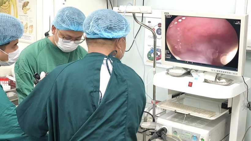 Các bác sĩ "cứu" thực quản người phụ nữ sau nhiều năm ăn cháo loãng