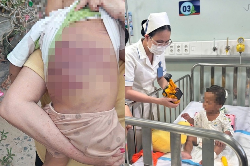 Hiện sức khỏe bé trai đang được theo dõi sát