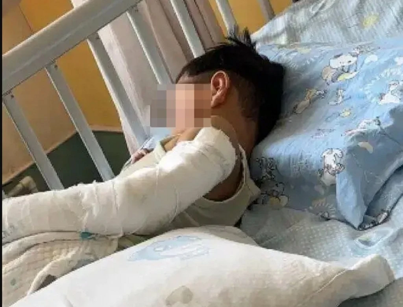 Cậu bé được điều trị tích cực tại bệnh viện. Ảnh: Sohu