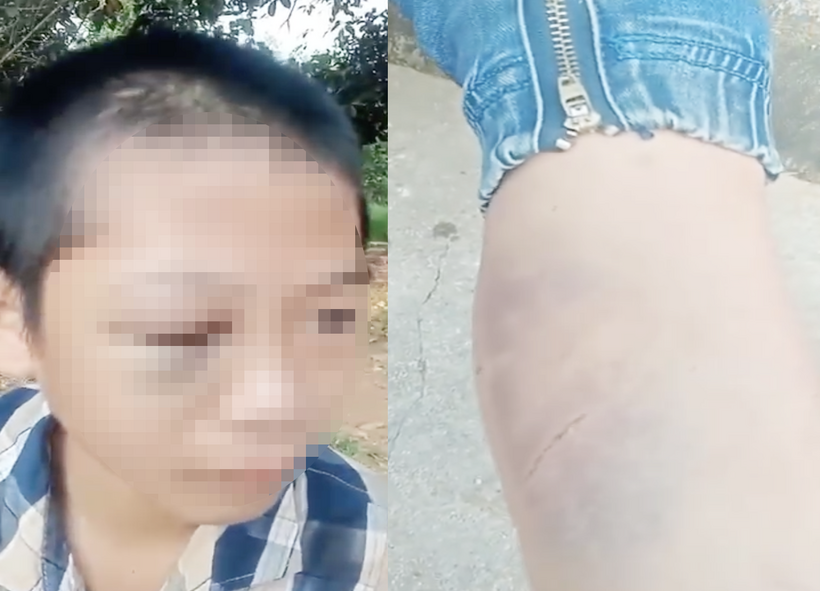 Hình ảnh cháu bé nghi bị bạo hành. Ảnh: Tuổi Trẻ