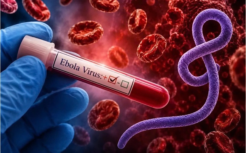 Việt Nam chủ động ứng phó nguy cơ Ebola xâm nhập từ quốc tế