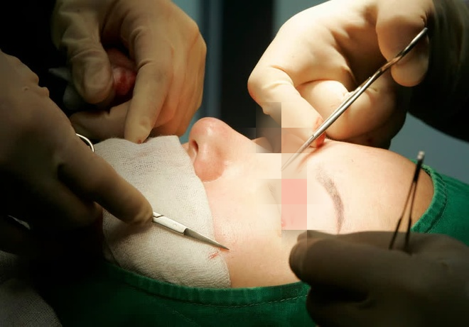 Phẫu thuật cắt mí được nhiều phụ nữ Trung Quốc lựa chọn. Ảnh: Reuters