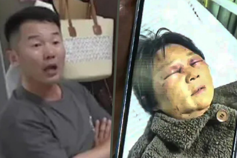 Bà Shen bị con dâu hành hung, gãy 4 xương sườn, con trai vẫn bên vợ. Ảnh: Sohu