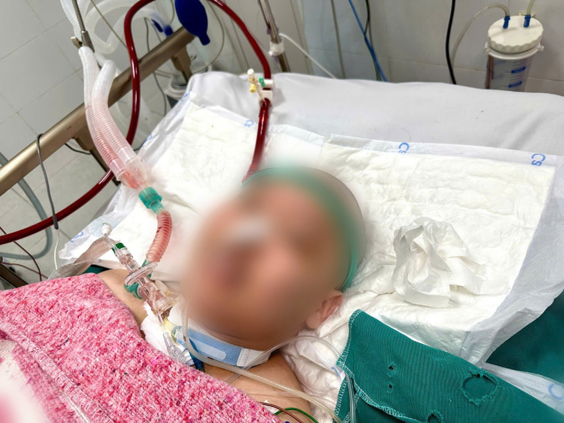 10 ngày giành giật sự sống cho nam bệnh nhân 25 tuổi bằng ECMO. Ảnh: BVCC