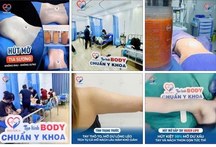 Một số nội dung quảng cáo dịch vụ thẩm mỹ của cơ sở Julia Aesthetic được đăng tải trên mạng xã hội. (Ảnh: Công an Hà Nội)