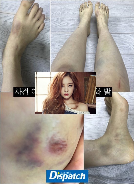 3 uẩn khúc quanh cái chết của Goo Hara: Chiếc két sắt biến mất cùng tên trộm bí ẩn, di chúc của nữ idol ở đâu? - Ảnh 10. 3 uẩn khúc quanh cái chết của Goo Hara: Chiếc két sắt biến mất cùng tên trộm bí ẩn, di chúc của nữ idol ở đâu? - Ảnh 10.