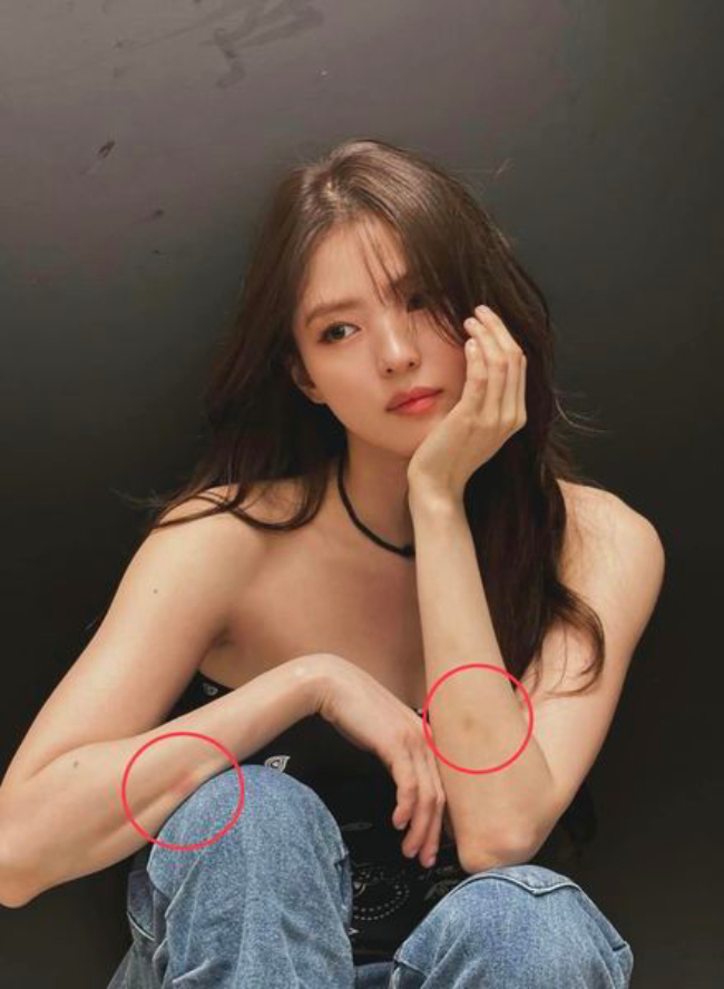 Loạt ảnh làm rộ tin Han So Hee bất ổn tâm lý hậu scandal, vết bầm tím khắp người càng gây xôn xao - Ảnh 9. Loạt ảnh làm rộ tin Han So Hee bất ổn tâm lý hậu scandal, vết bầm tím khắp người càng gây xôn xao - Ảnh 9.