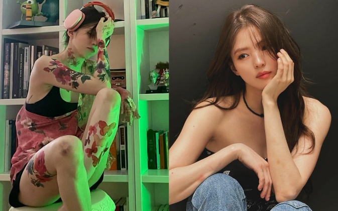 Nóng: Bắt khẩn mẹ Han So Hee vì tội điều hành 12 sòng bạc trái phép- Ảnh 1. Loạt ảnh làm rộ tin Han So Hee bất ổn tâm lý hậu scandal, vết bầm tím khắp người