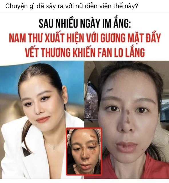 Hình ảnh thương tích của Nam Thư gây hoang mang - Ảnh 2. Hình ảnh thương tích của Nam Thư gây hoang mang - Ảnh 2.