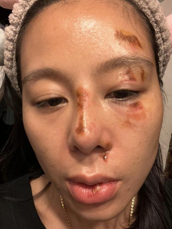 Hình ảnh thương tích của Nam Thư gây hoang mang - Ảnh 3. Hình ảnh thương tích của Nam Thư gây hoang mang - Ảnh 3.