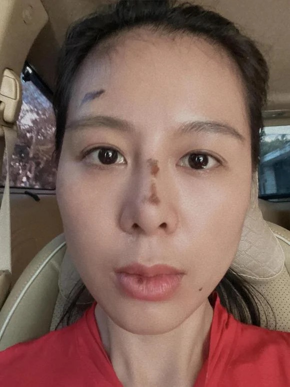 Hình ảnh thương tích của Nam Thư gây hoang mang - Ảnh 4. Hình ảnh thương tích của Nam Thư gây hoang mang - Ảnh 4.