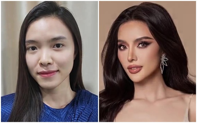 Lộ nhan sắc khi chưa thẩm mỹ của cô gái "bại trận" trước Lê Võ Quế Anh- Ảnh 2. Lộ nhan sắc khi chưa thẩm mỹ của cô gái "bại trận" trước Lê Võ Quế Anh- Ảnh 2.