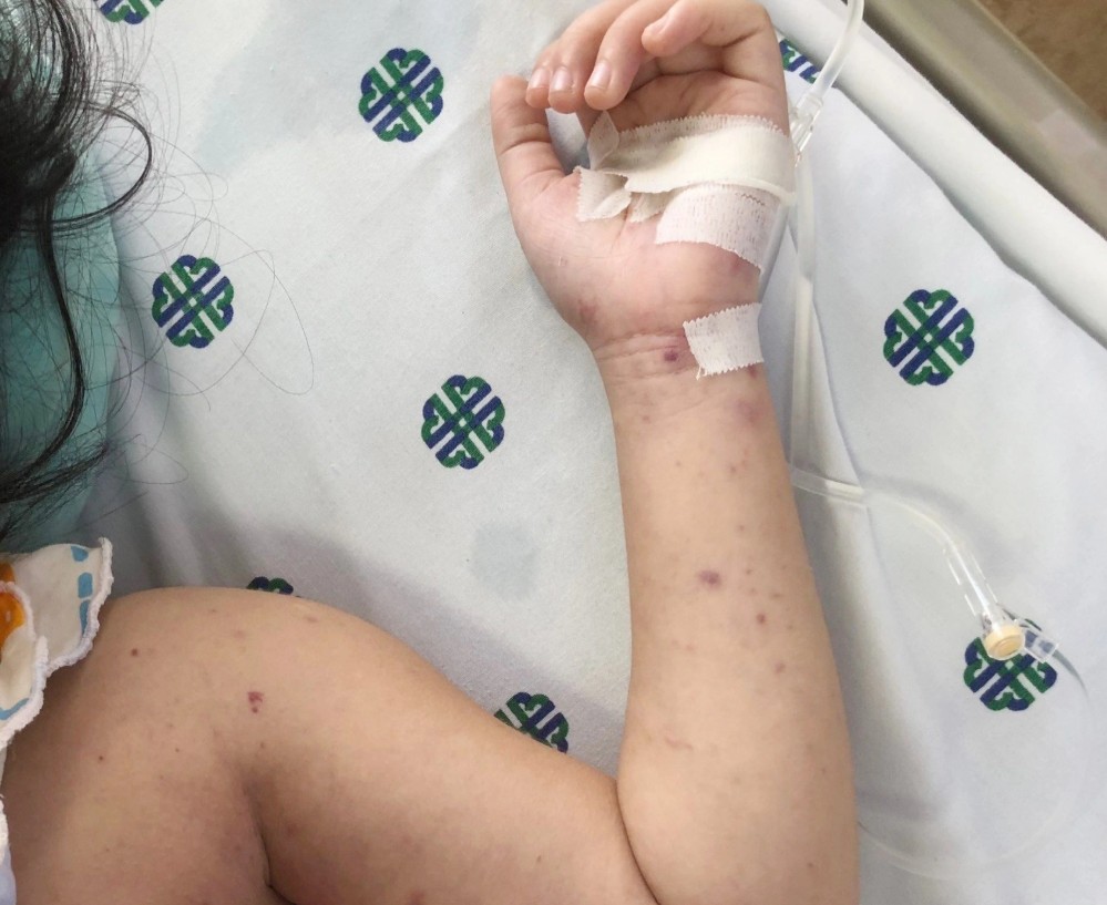 viem mang nao mo cau 2