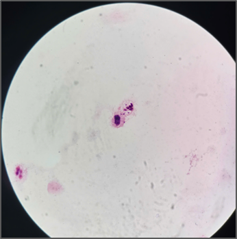 viem nao mo cau 4 viem nao mo cau 4