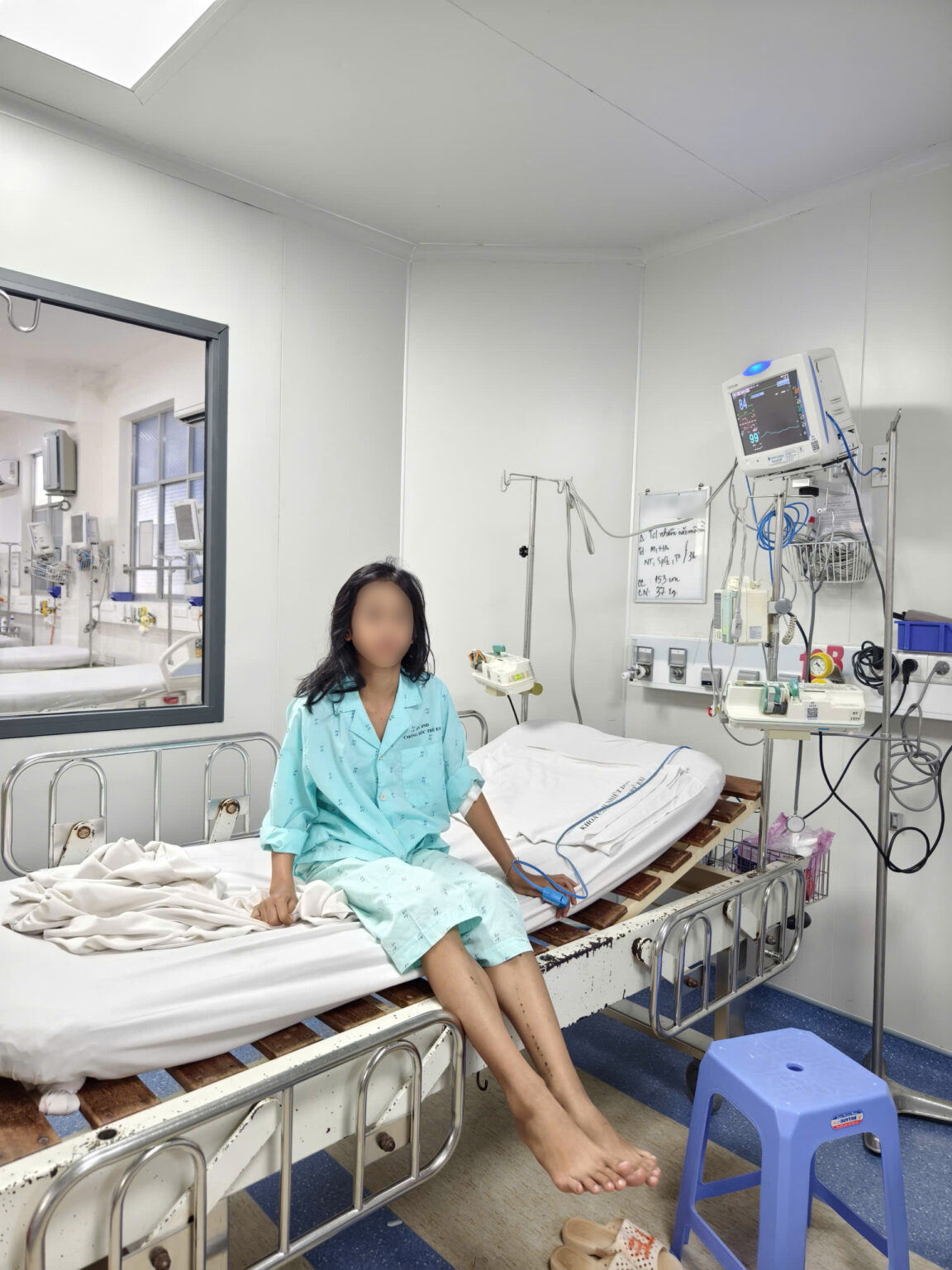 viem nao mo cau 1 viem nao mo cau 1