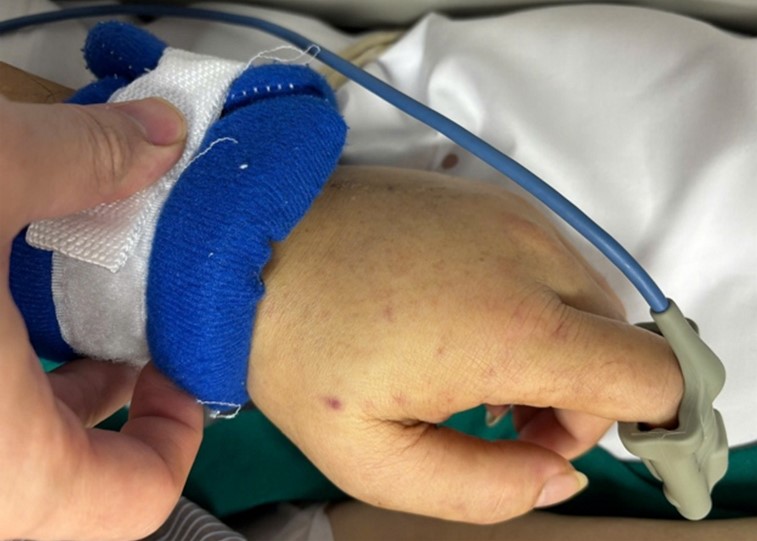 viem nao mo cau 5 viem nao mo cau 5