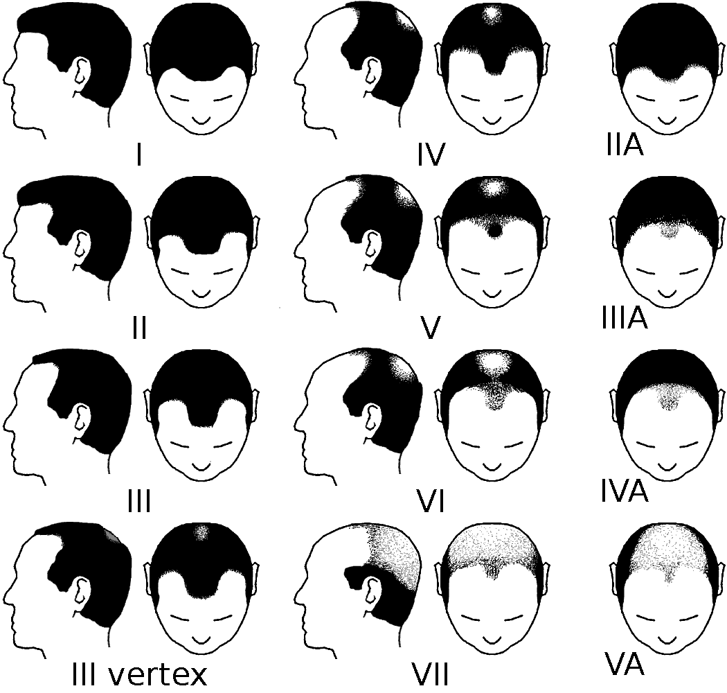 anh minh hoa 11