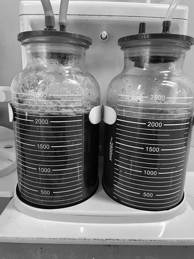 edit tai bien tiem filler 1751869011370973532242