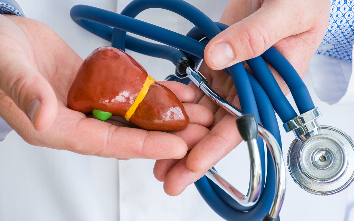 fatty liver disease feat 1663232747964138802659 30 0 780 1200 crop 16632327621412029085789