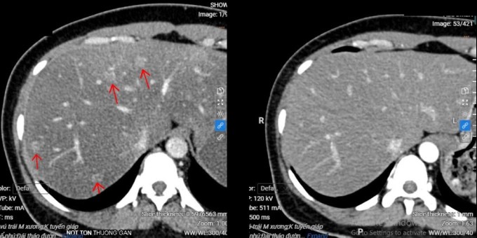 a 1 1754927259 1411 1754927373