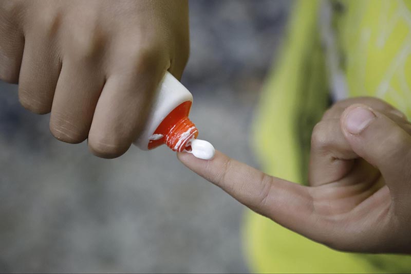 thoa kem danh rang truc tiep len da tay