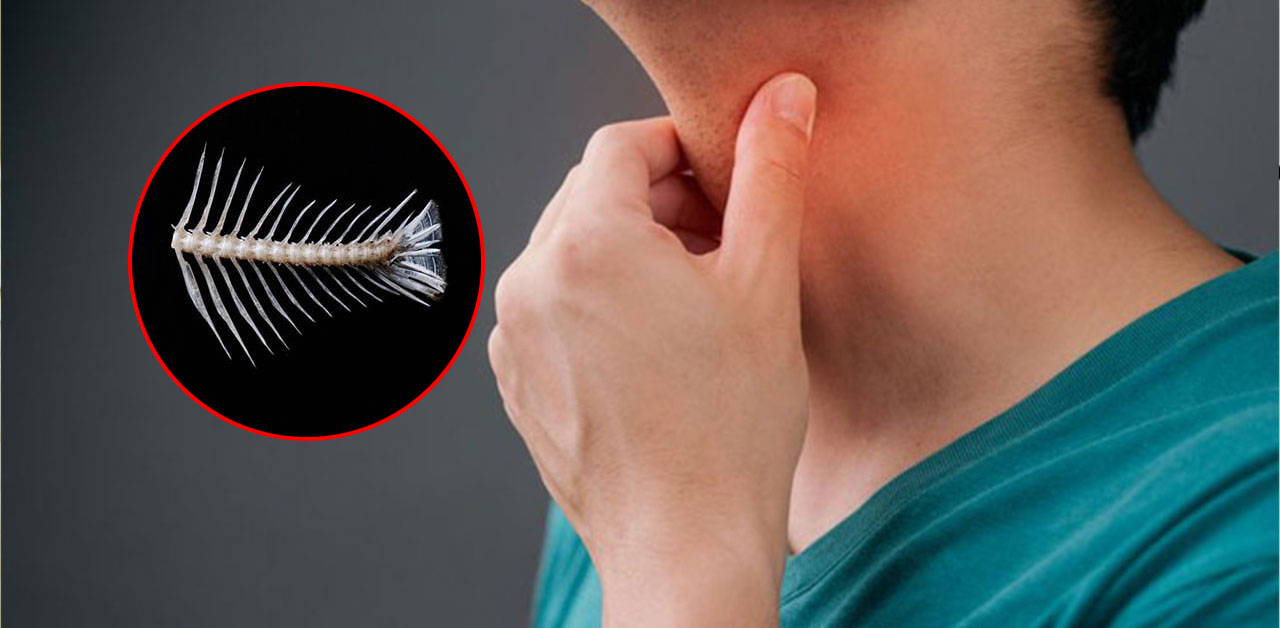 hoc xuong ca uong thuoc gi