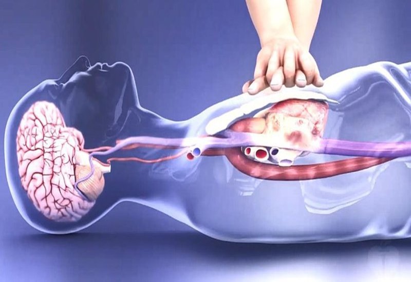 20220920cap cuu ngung tuan hoan bo y te 2