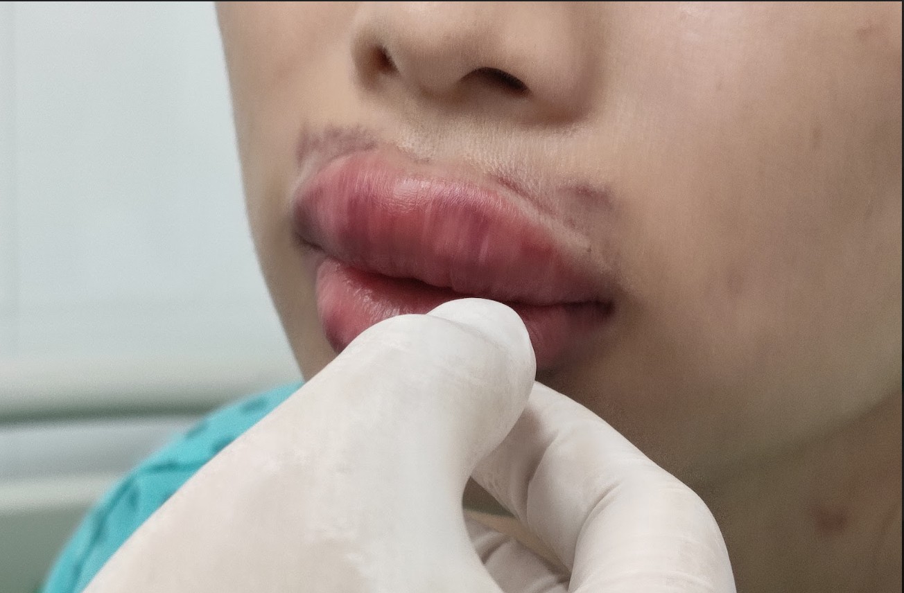 anh chup man hinh 2022 09 09 luc 154656 16627132466311621410207