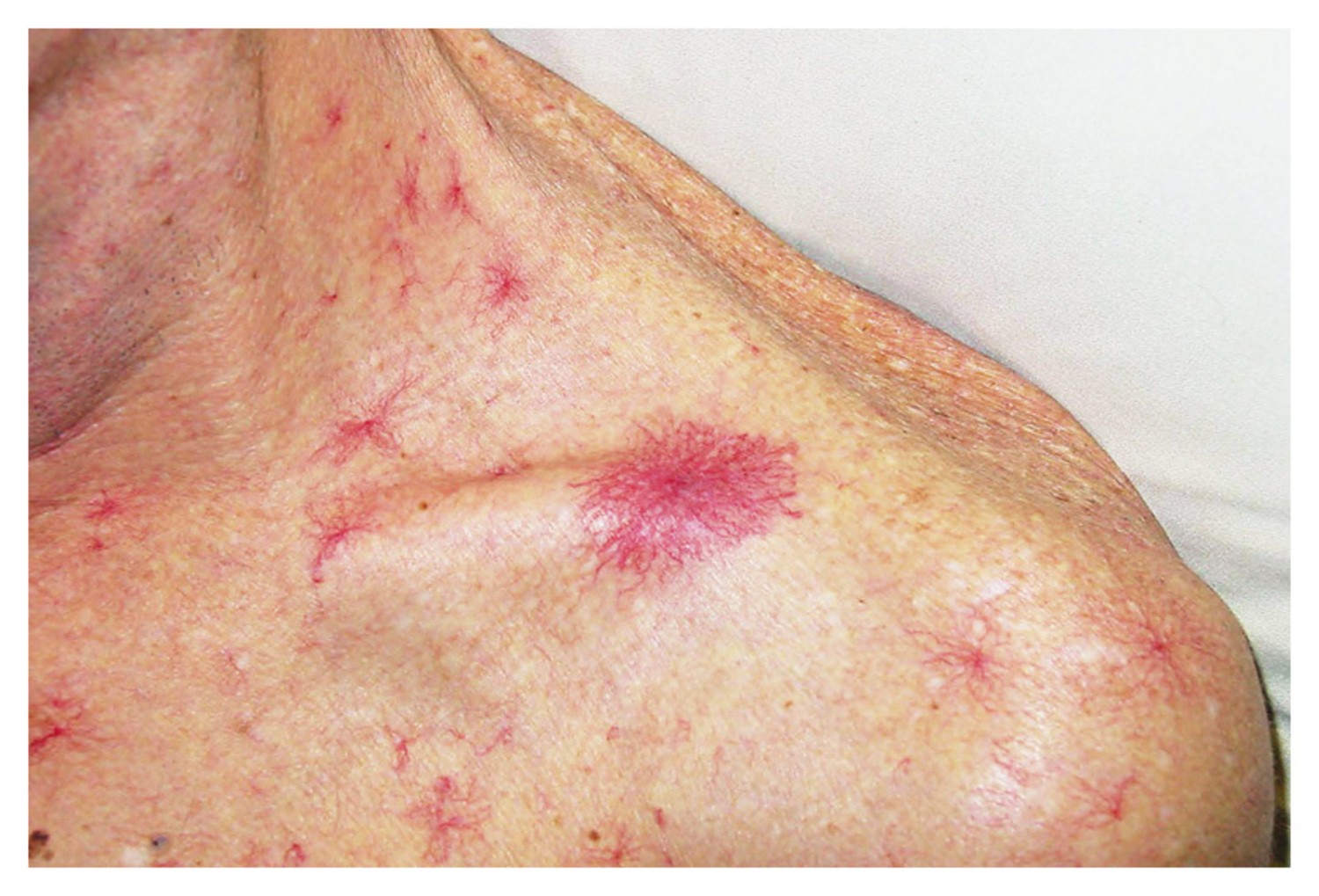 dau hieu ton thuong gan 1765671855960 176567185624712691944