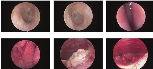 2 benh ung th 1773121604