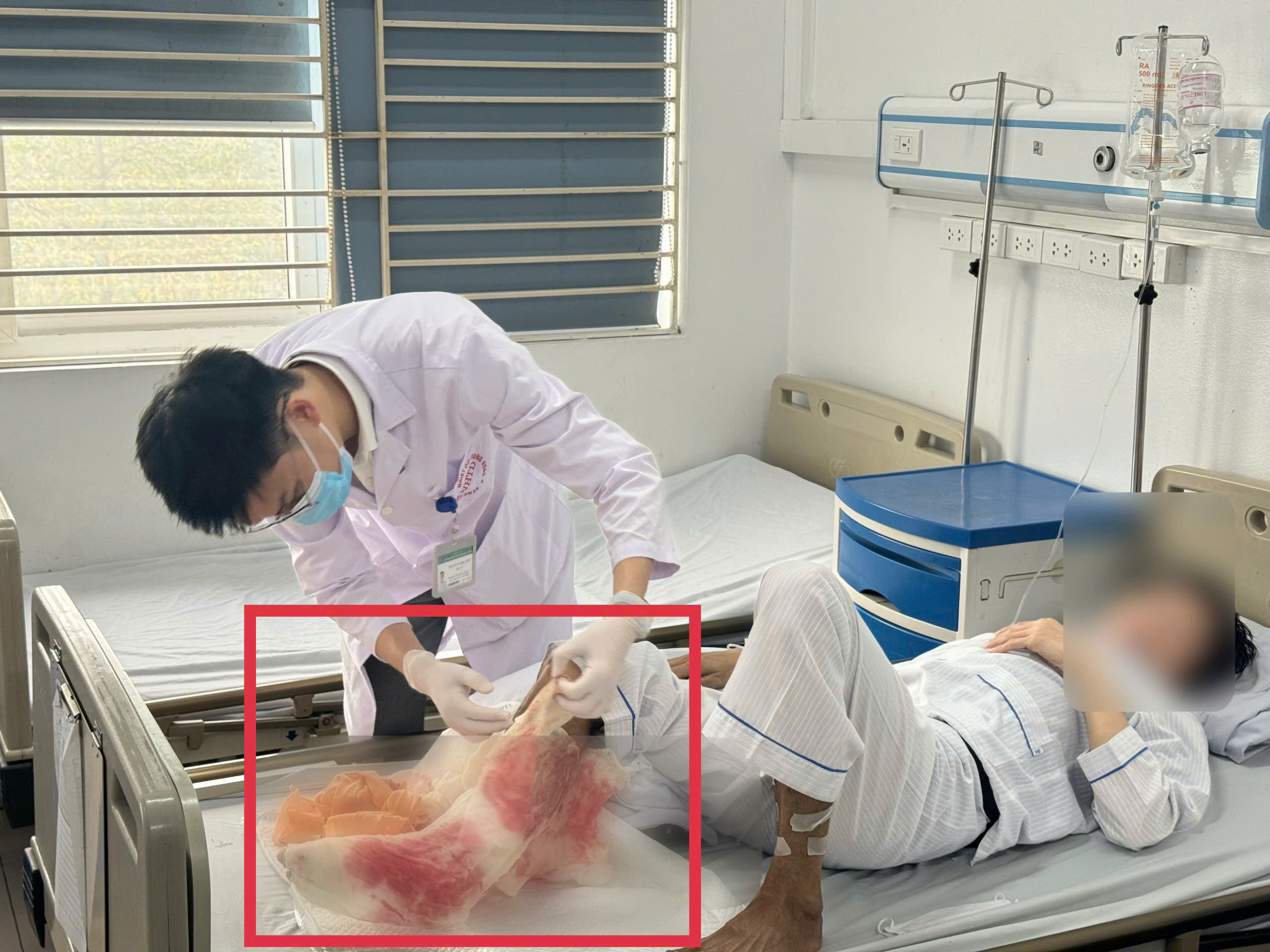 suyt mat chan vi dap thuoc la 17732844445211643857805