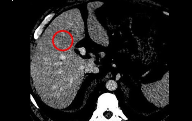 base64 1773974764442931612193