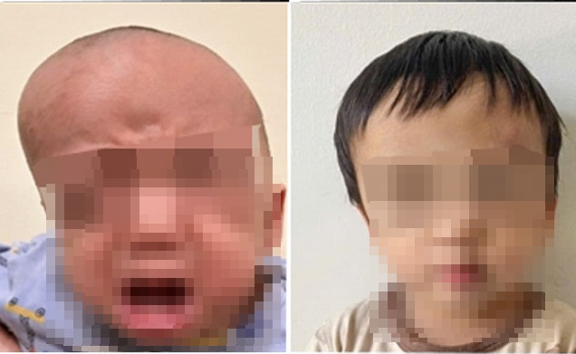 benh nhi 2