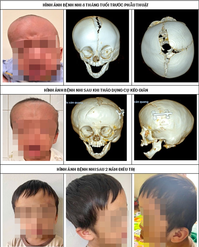 benh nhi 4