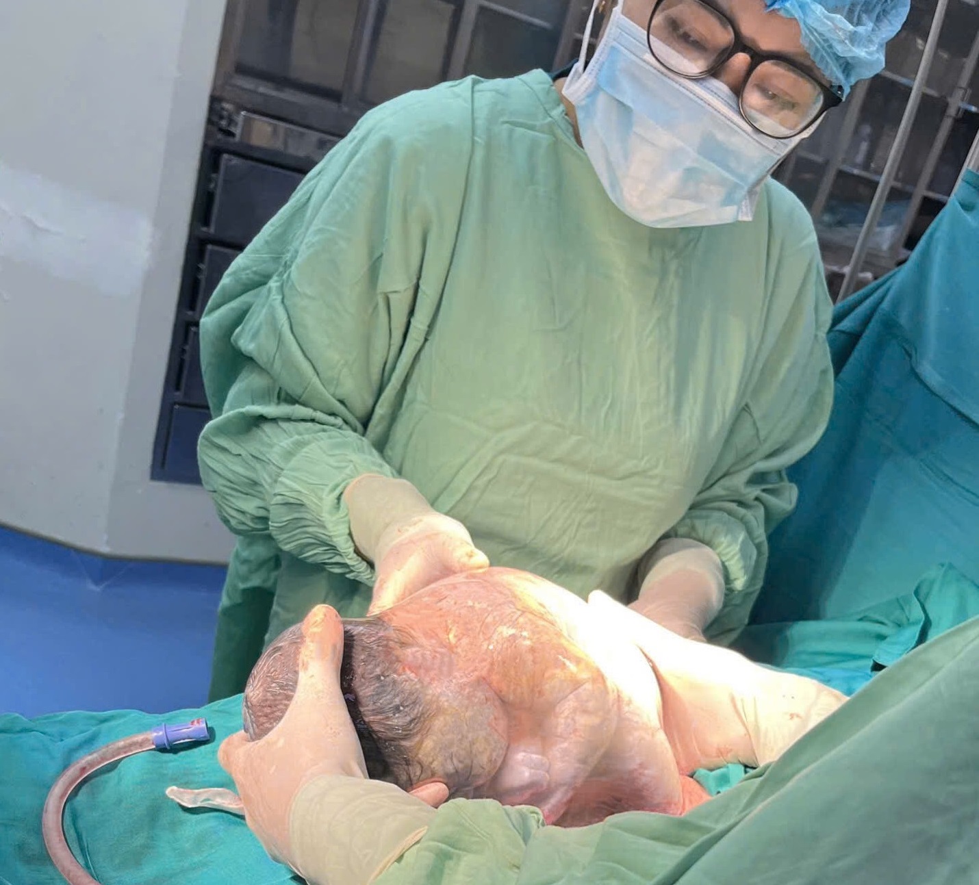 Bé gái sinh ra trong bọc điều tại bệnh viện Hoàn Mỹ Vinh