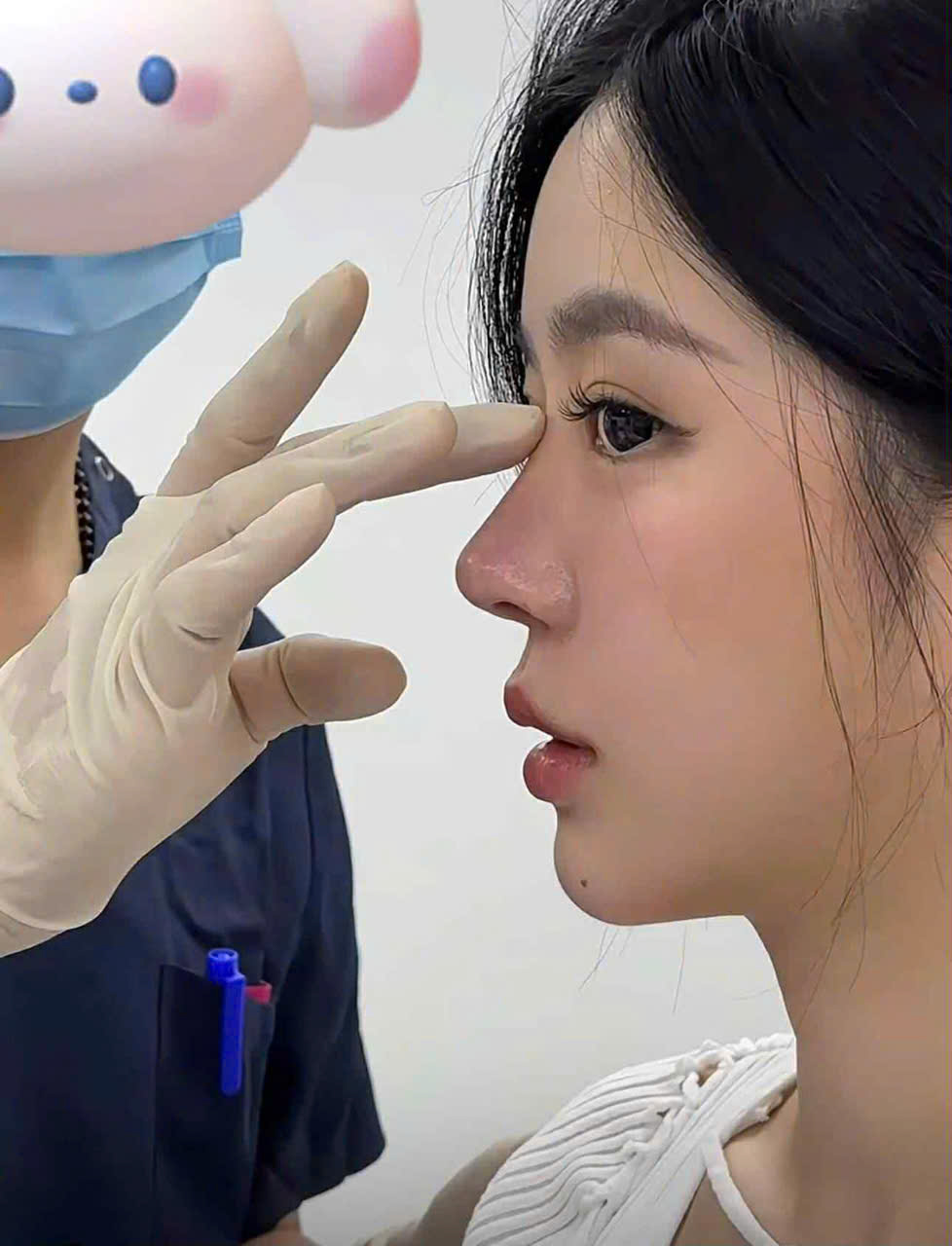 tham my vien tran tra 3