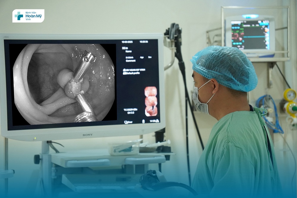 benh vien hoan my vinh goi kham suc khoe tong quat 03 11