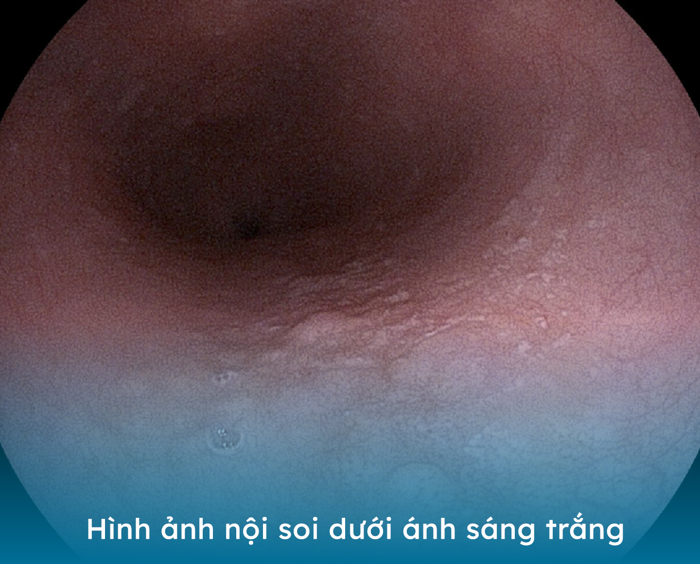 nh 1