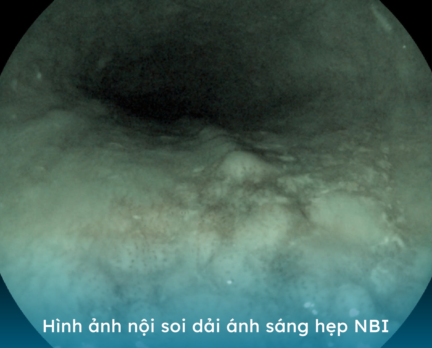 nh 2