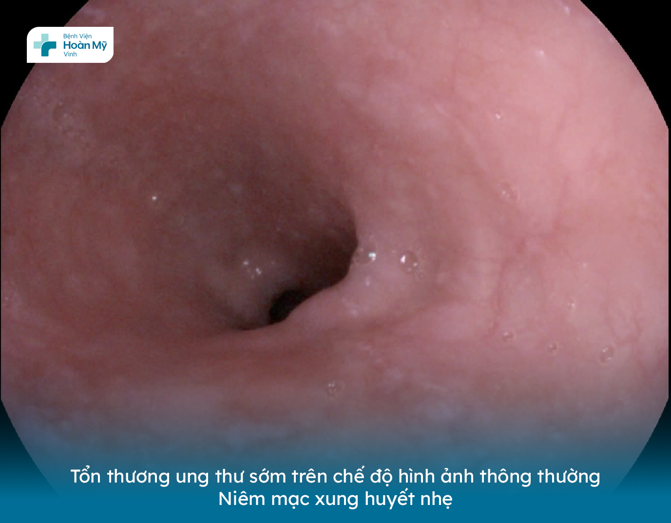benh vien hmv 1