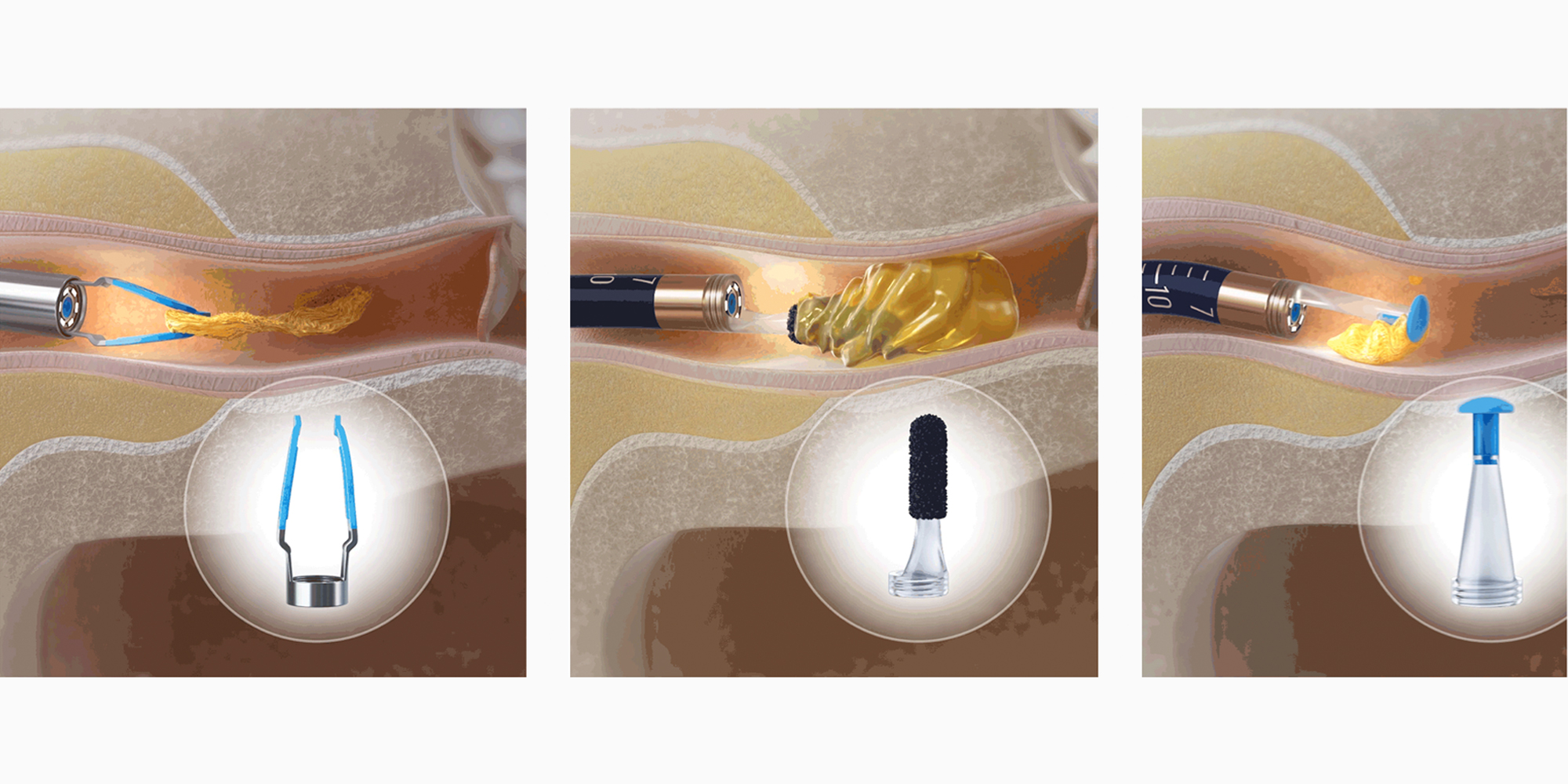 grafikaurzdzenie do czyszczenia uszu bebird earsight plus r37r biay03