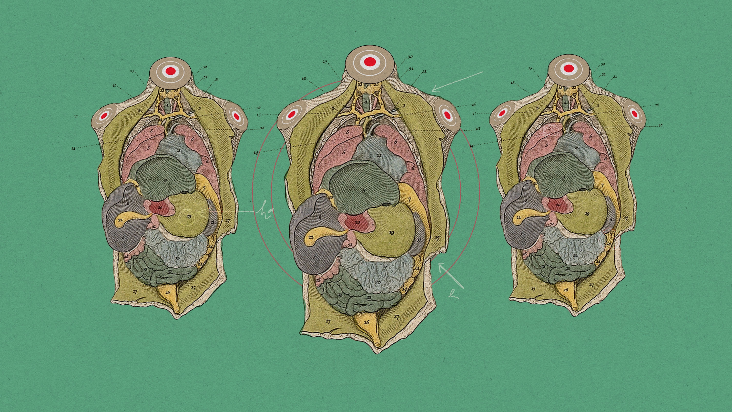 headless oids