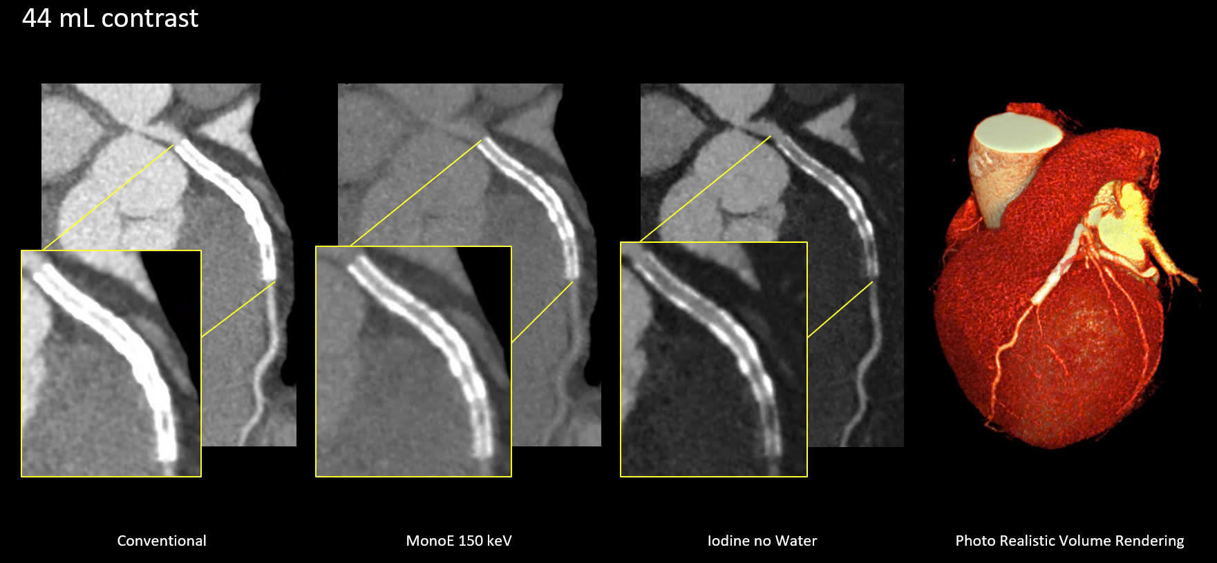 319ddddc b976 4aa7 b425 50b07438eec1