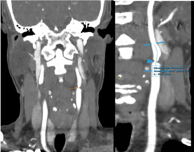 cda08940baf409aa50e5