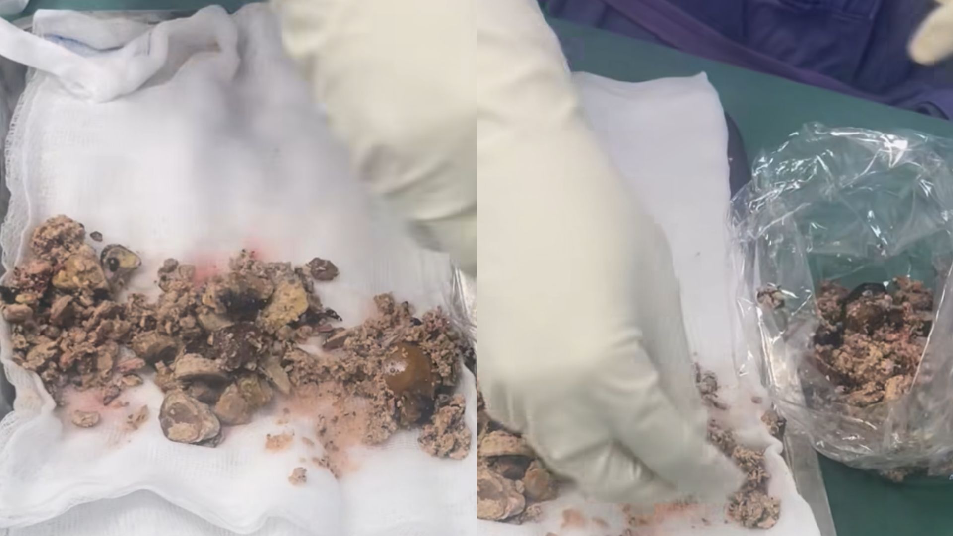 hat nano nhua co the truyen tu me sang thai nhi o chuot 24