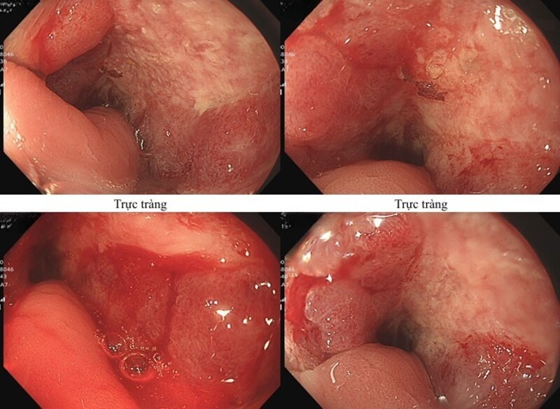 51833693131327185135451482543527915213355565n