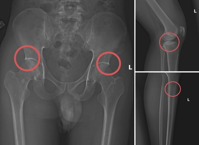 2 1763121411 1763121518 2856 176 1 1503