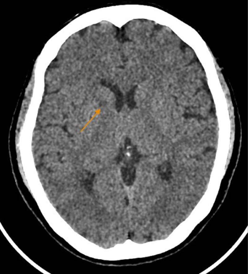 59232941732787761422727177454440169242912865n