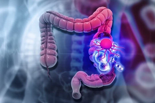 360f672094723ljti0brythyd8o9nuuxaxtwjmx529dr01