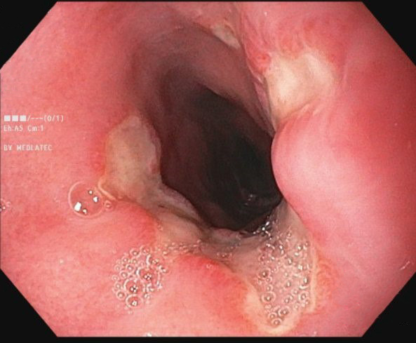 59993955632961937038642942355098408015608645n